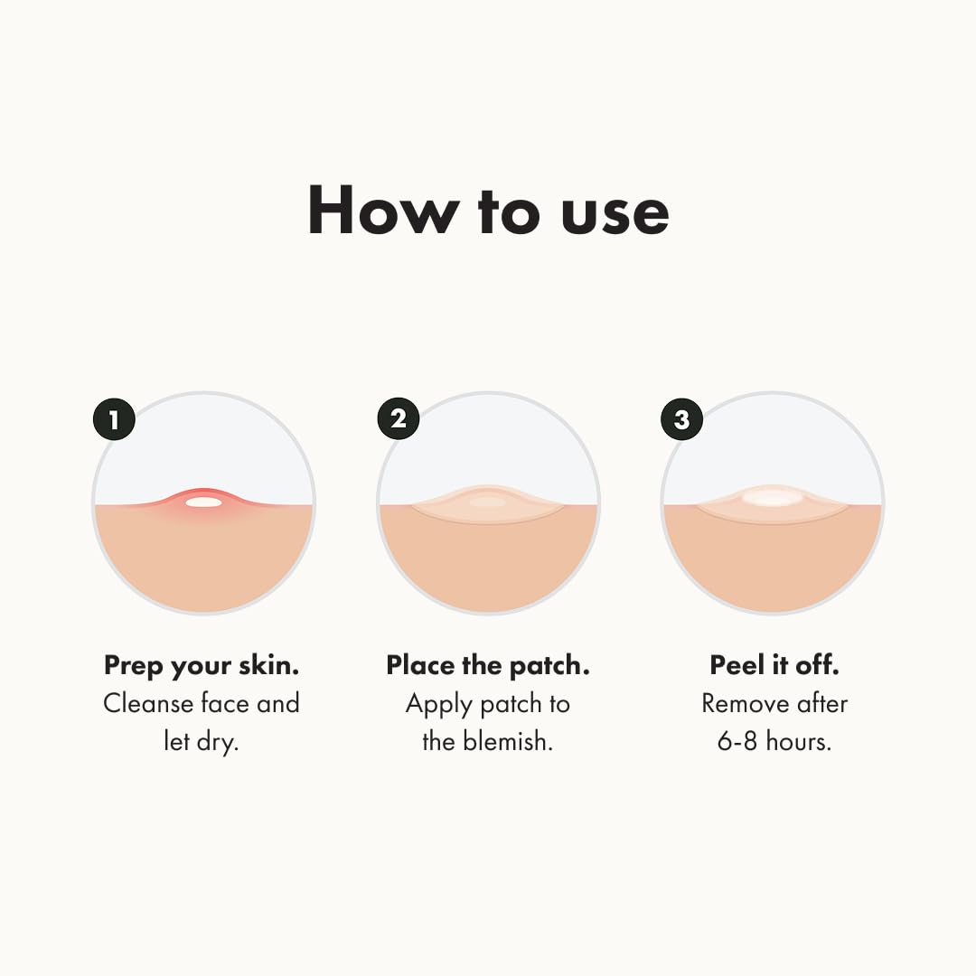 Hydrocolloid Acne Pimple Patches – Original Nighttime Spot Stickers for Shrinking Zits and Whiteheads in One Use (36 Count)