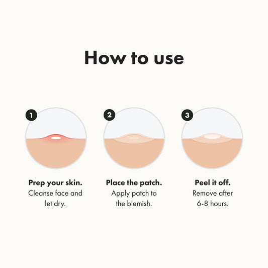 Hydrocolloid Acne Pimple Patches – Original Nighttime Spot Stickers for Shrinking Zits and Whiteheads in One Use (36 Count)