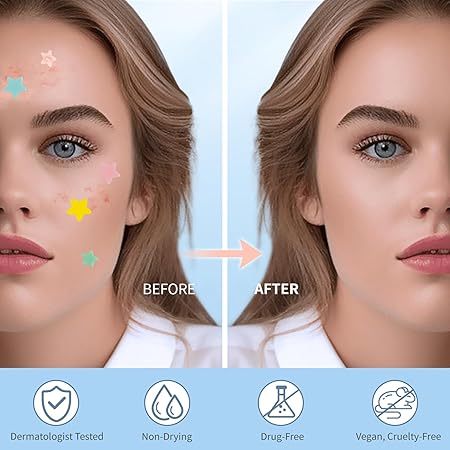 Pimple Patches for Face – Hydrocolloid Acne Spot Stickers with Tea Tree, Salicylic Acid & Cica Oil – Colorful Star-Shaped Zit Covers – 3 Sizes (10mm, 12mm, 14mm) – 200 Count